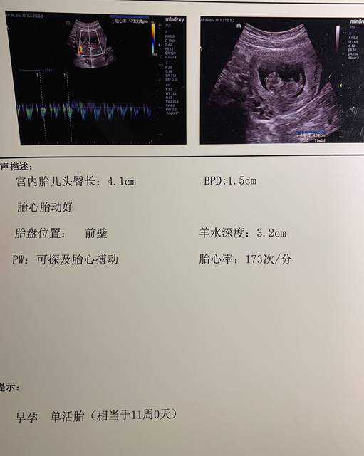 重庆医科大学附属第一医院试管婴儿专家推荐及助孕指南